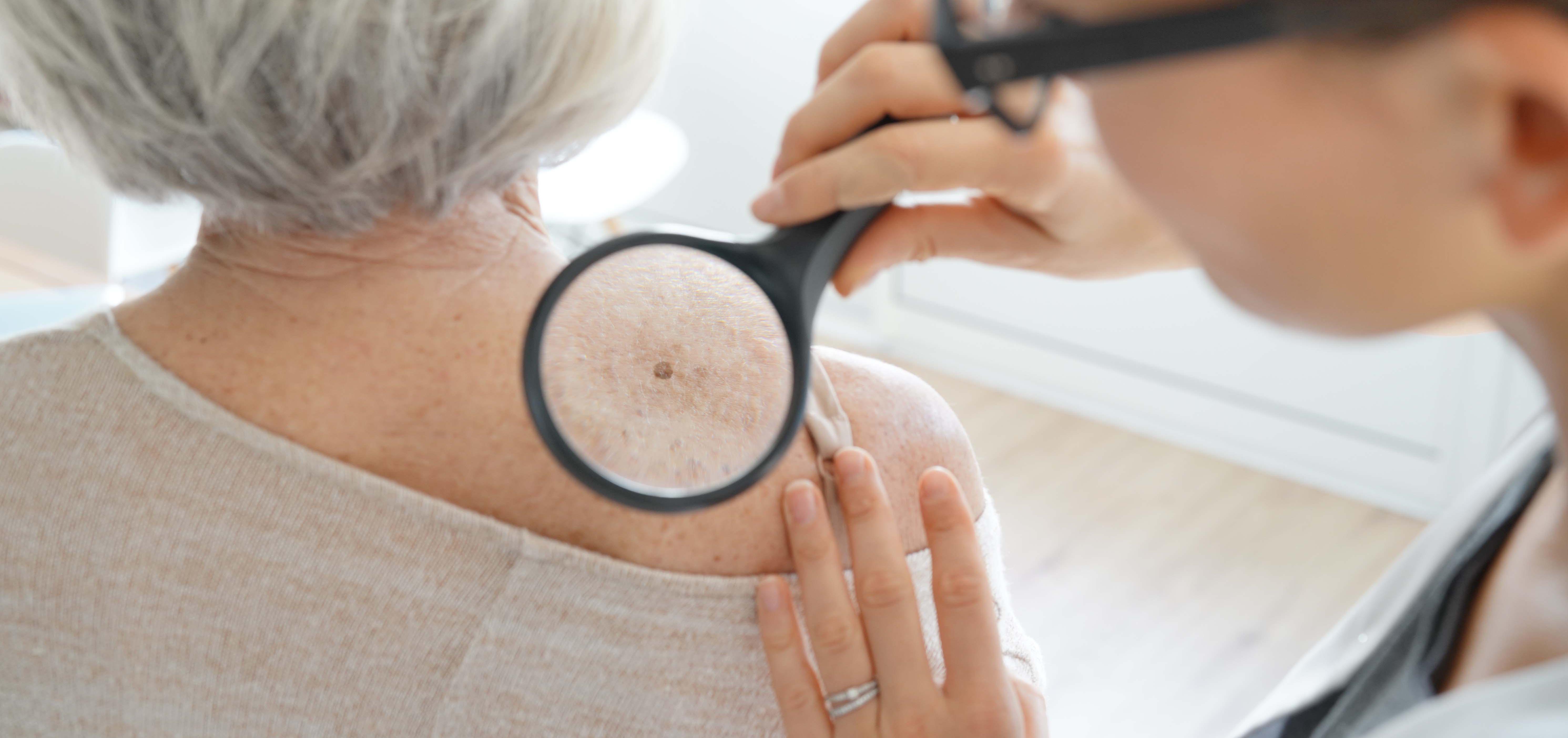 Woman with dermatologist.