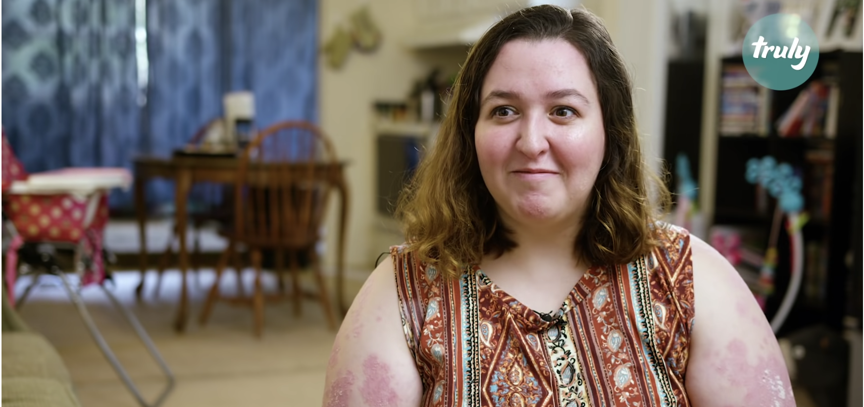 Sabrina, who was diagnosed with severe plaque psoriasis when she was 12 years old, shares what it’s like to live with severe psoriasis.