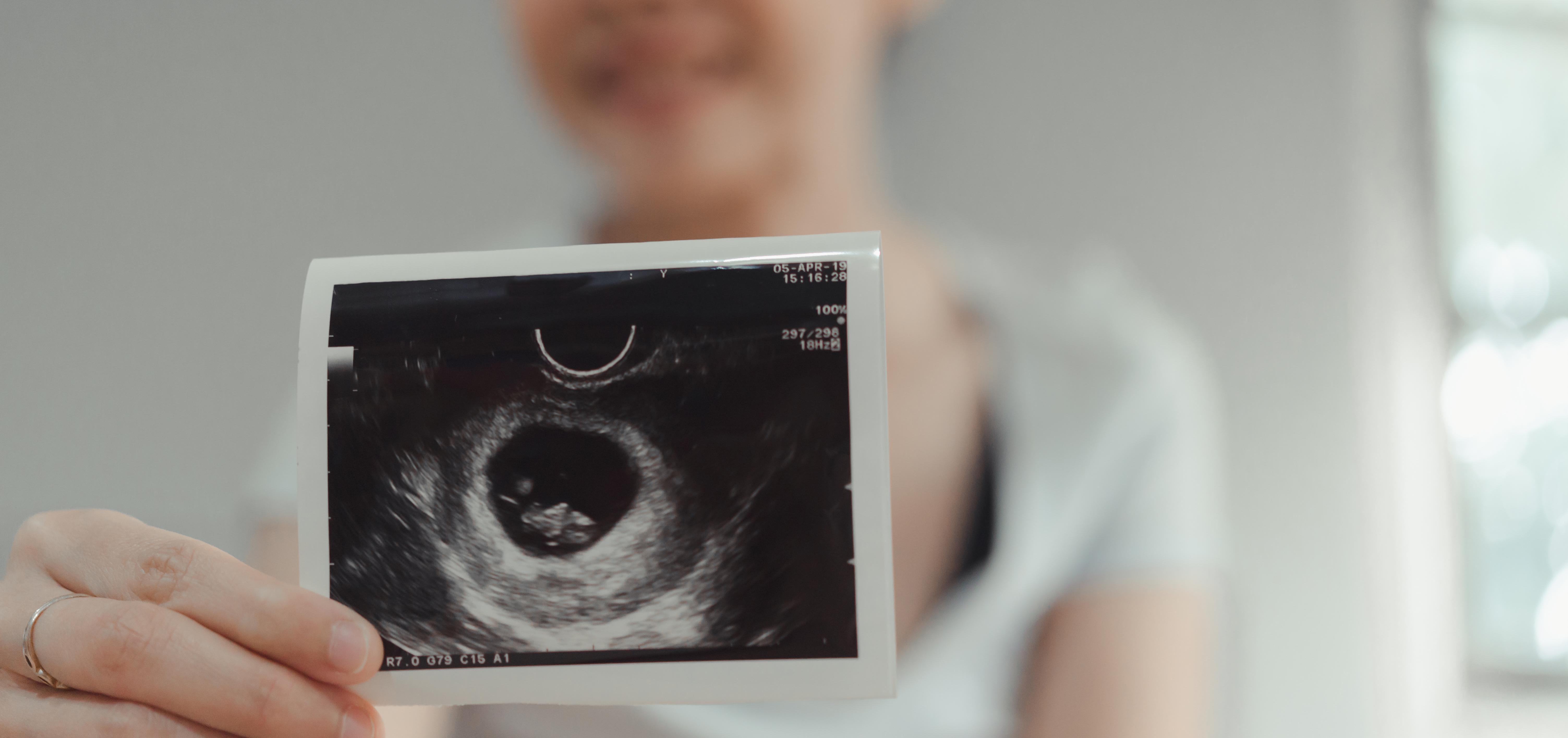 woman holding an ultrasound photo from her first prenatal visit