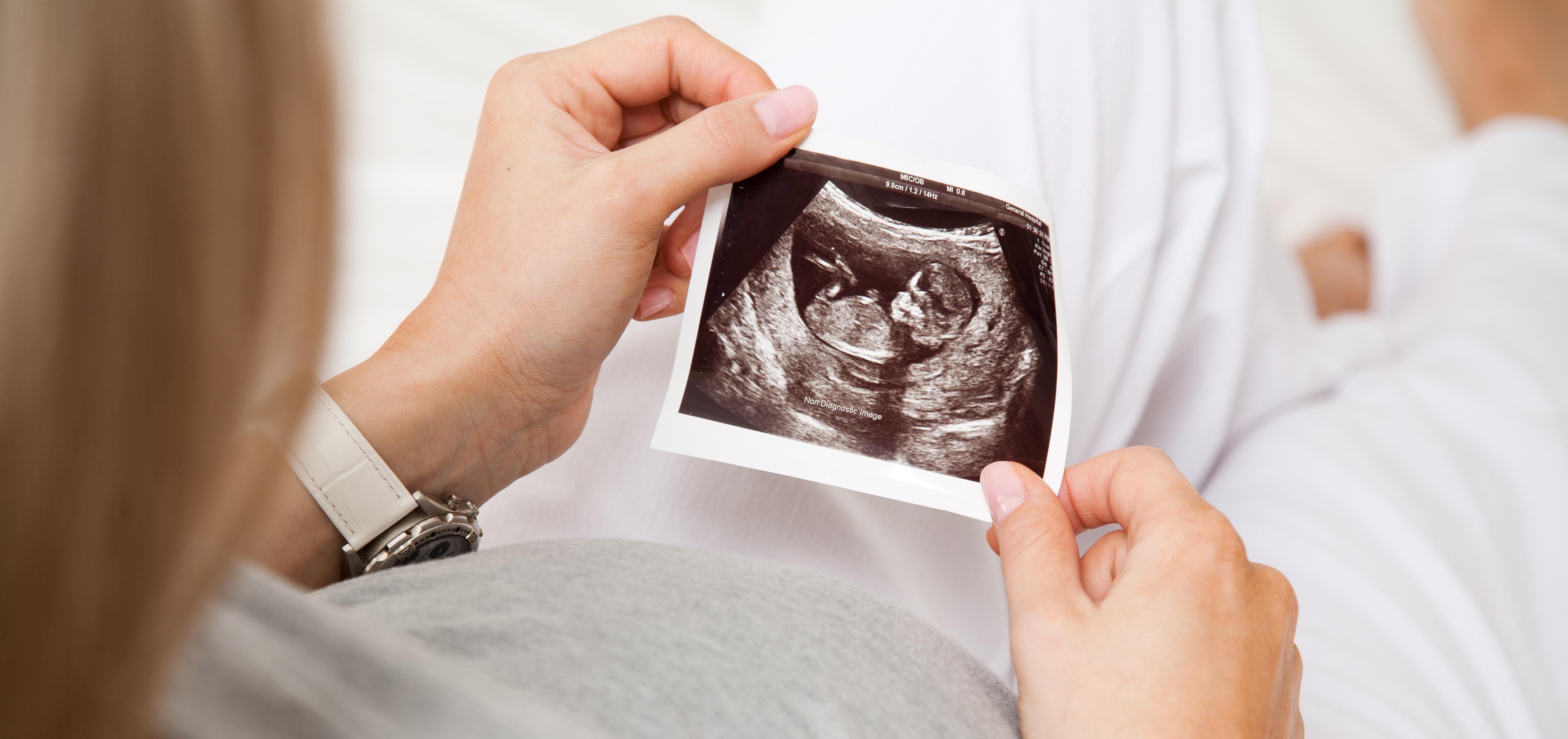 pregnant woman holding ultrasound image