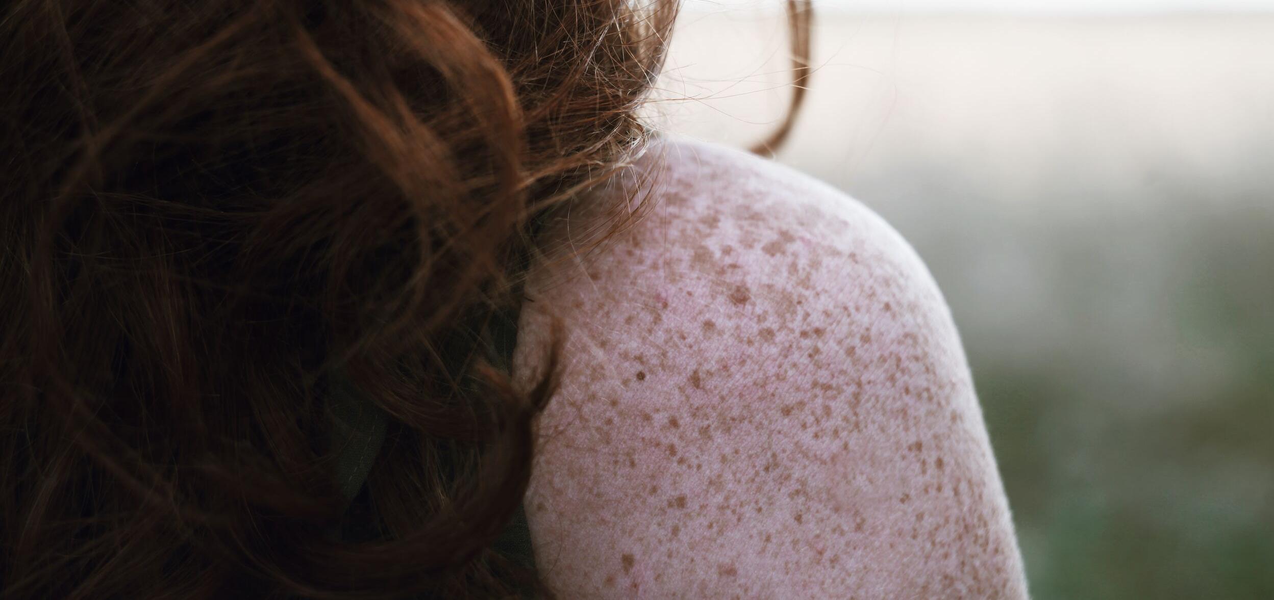 Close up of freckly skin on a woman's shoulder